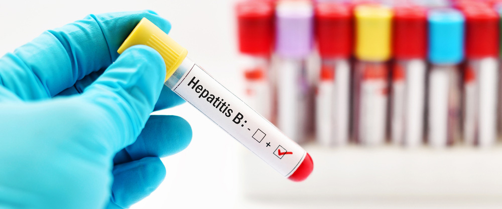 Kaj je hepatitis B? Kakšni so simptomi in metode zdravljenja?